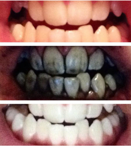 Mẹo làm trắng răng, mi cong không tốn tiền