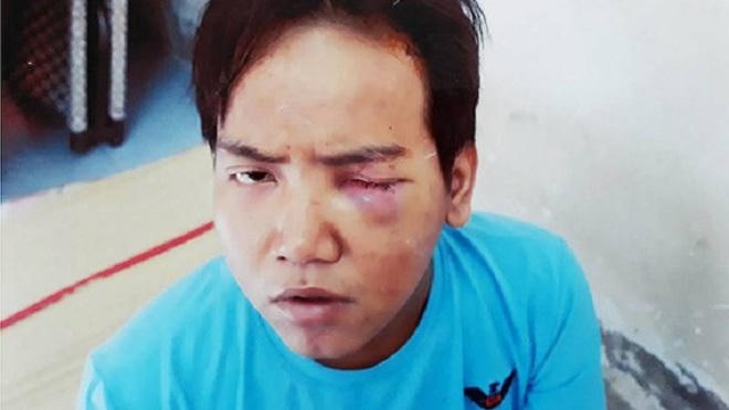 Vụ nghi phạm tâm thần sát hại bé trai sáu tuổi - nỗi đau chất chồng của người mẹ mất con