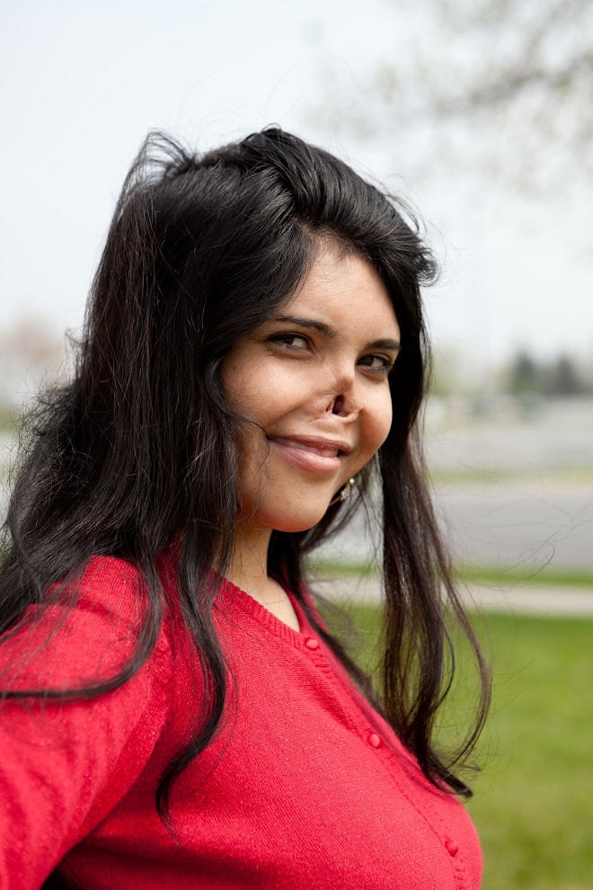 Kinh hoàng tàn dư hủ tục phân biệt đối xử phụ nữ ở Afghanistan