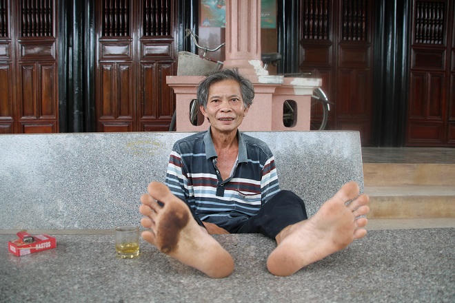 Tuyệt chiêu “điểm huyệt” độc nhất vô nhị của võ sư 1 chân đen 1 chân trắng