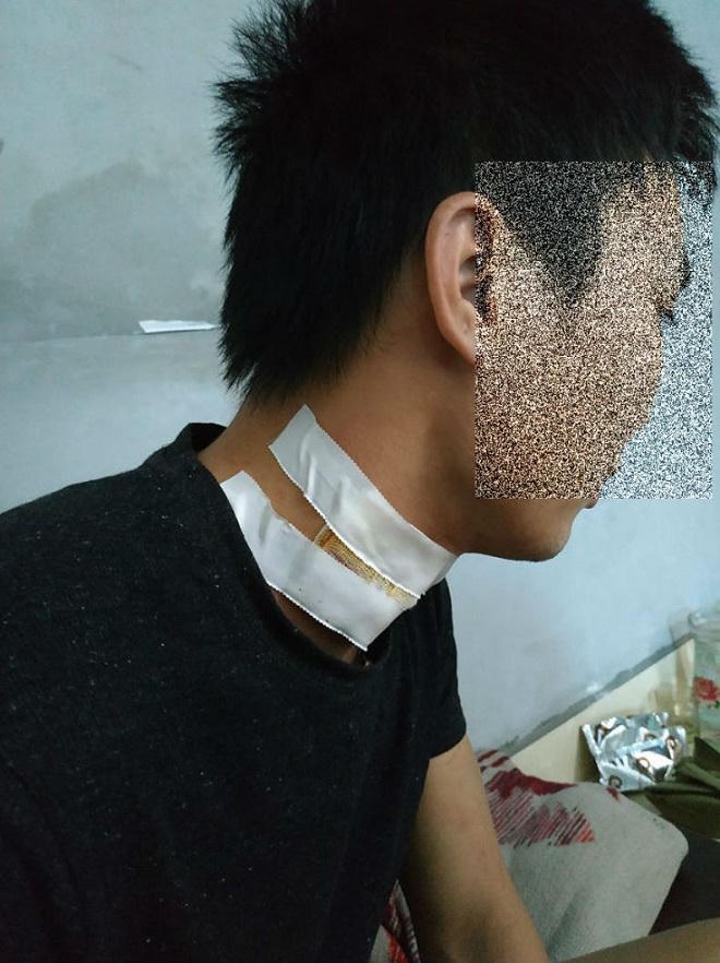 Vụ cướp táo tợn: Tài xế taxi thoát hiểm trong gang tấc nhờ may mắn hạ cửa kính