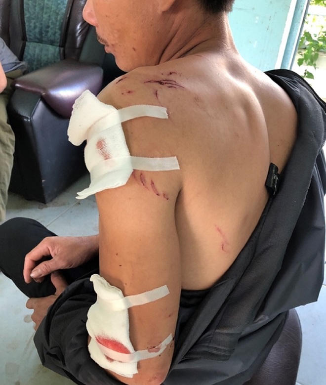 Dùng dao chém liên tiếp bố mẹ để trừ… “ma”