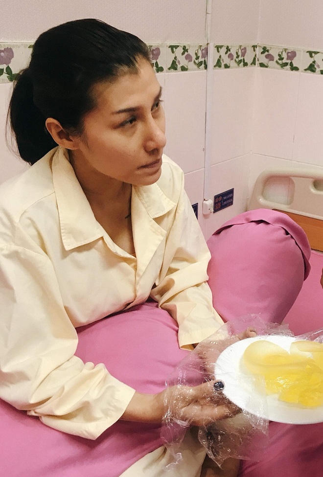 Sư thật sau chiêu quảng cáo 'phẫu thuật thẩm mỹ bảo hành trọn đời'