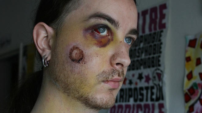 Loại súng cao su gây ra cuộc tranh luận gay gắt