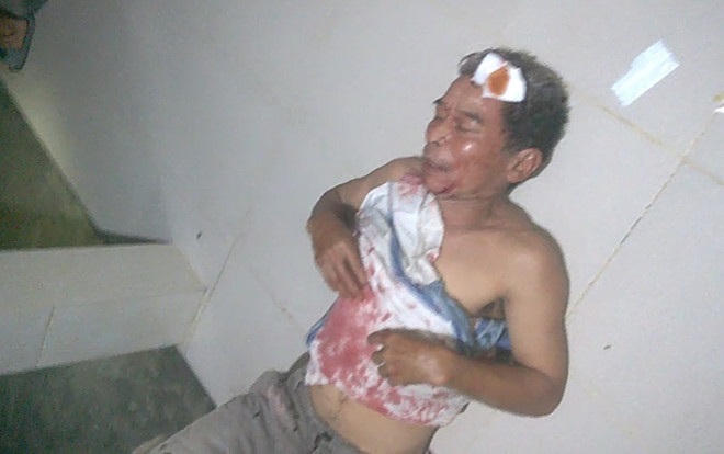 Thừa Thiên – Huế: Đuổi “cát tặc”, hai nông dân bị chém trọng thương