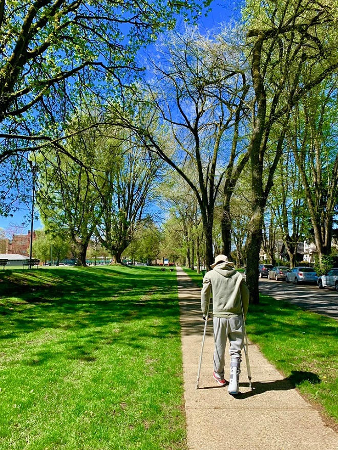 Bất ngờ hình ảnh về nam Việt kiều bị tạt axit do người yêu chia sẻ