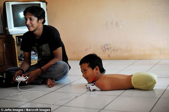 Nụ cười vẫn tỏa sáng trên gương mặt cậu bé không chân, không tay