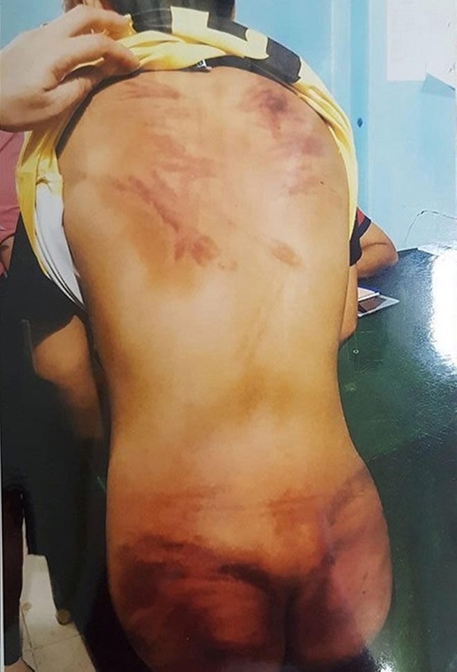 'Thầy tu' tự phong đánh đập cháu bé 11 tuổi: Hồ sơ thọ giới có sự giả mạo