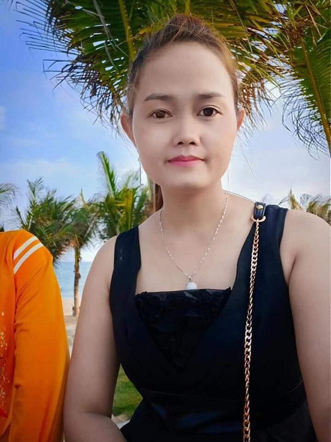 Thương tâm người vợ trẻ bị chồng thiêu biến dạng cơ thể