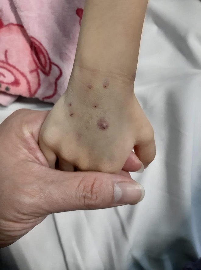 Nhật ký đẫm nước mắt của người cha cạo đầu cùng con chiến đấu với ung thư