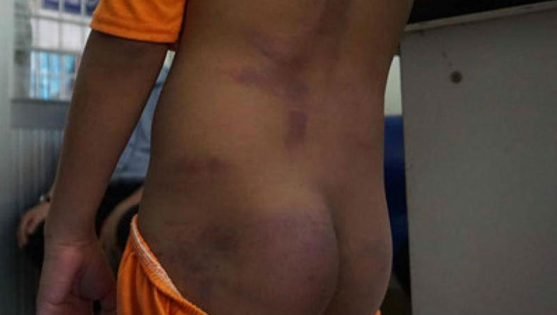 Nguyên nhân nào khiến ông nội đánh tím người 4 cháu nhỏ ở Cà Mau?