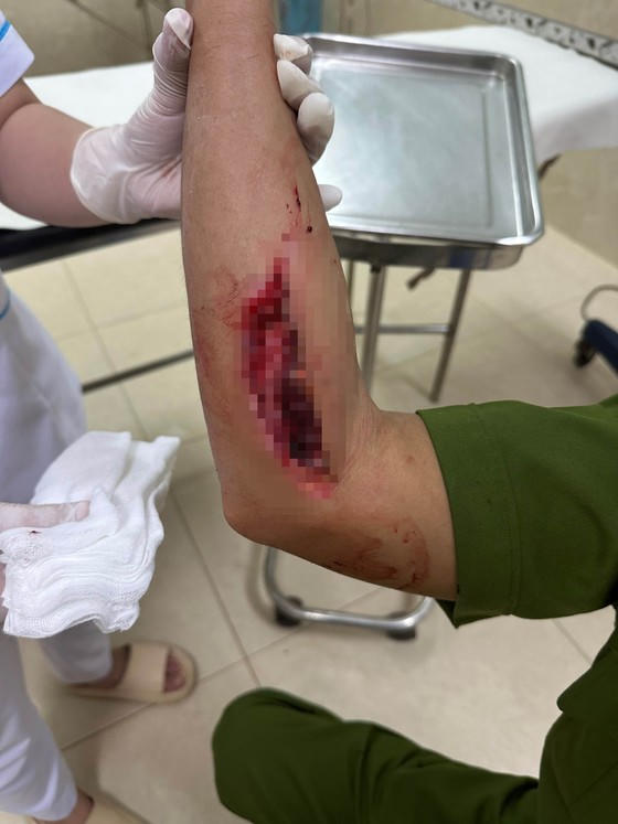 "Say xỉn", người đàn ông tông thẳng xe vào Trung tá công an