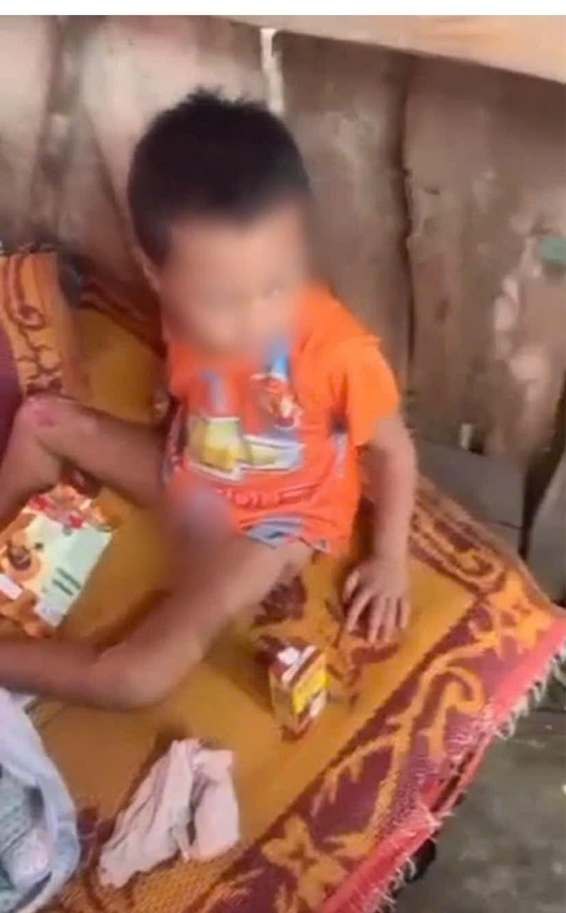 Bé trai bị “bỏ rơi” đến hoại tử xương cụt: Tiếng kêu ám ảnh vị trưởng làng “Ông ơi, cứu cháu với”