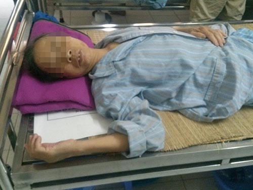 Bị côn trùng đốt có thể nguy hiểm đến tính mạng