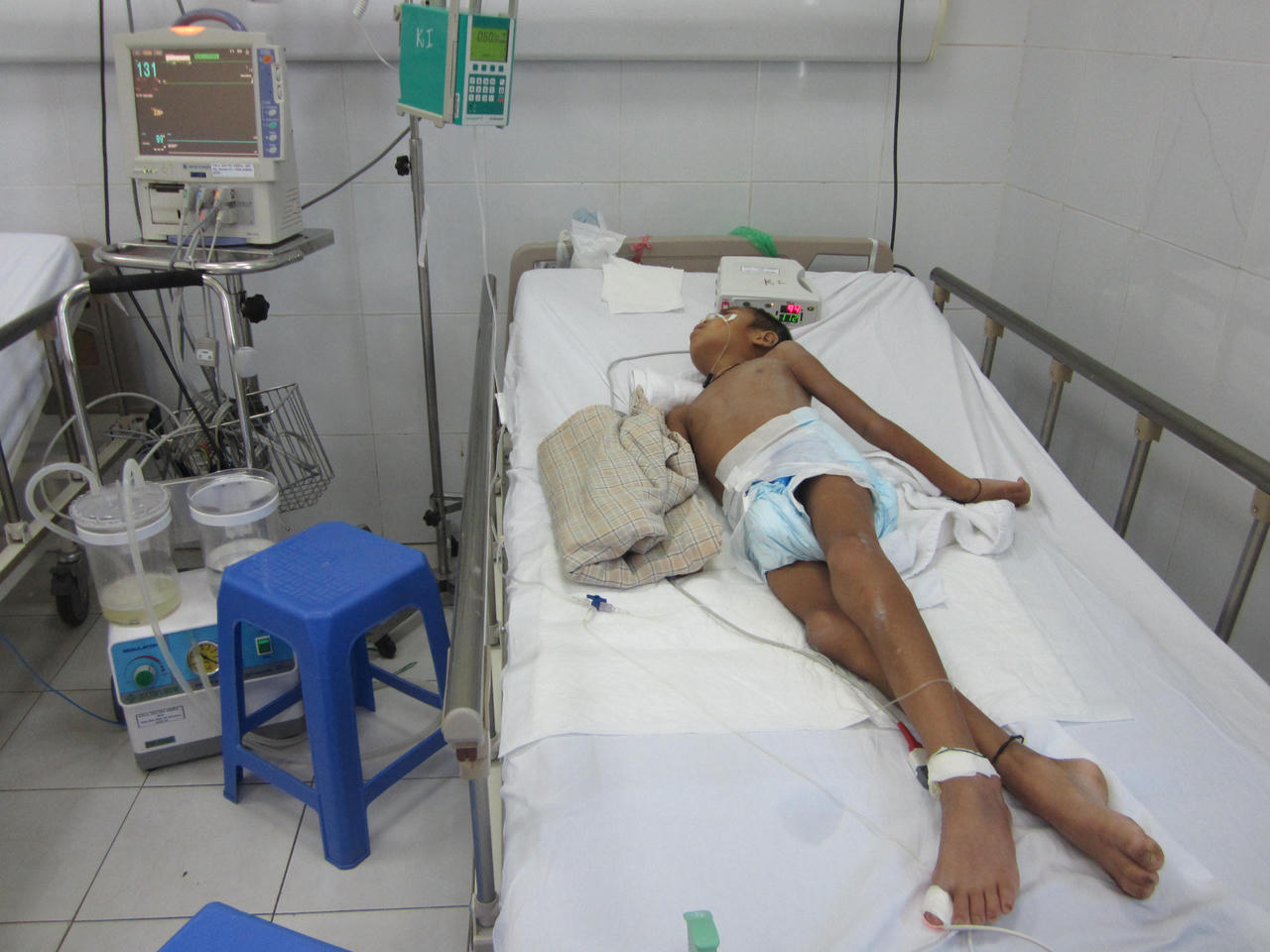 Gia tăng bệnh nhi biến chứng nặng do Viêm não Nhật Bản