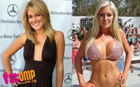 7 lý do để “tạm biệt” phẫu thuật thẩm mỹ