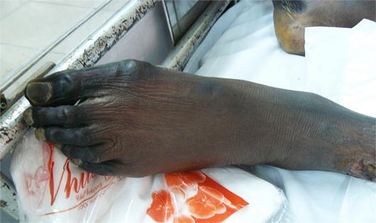 Hình ảnh hãi hùng vì ăn tiết canh khi mổ lợn đón Tết