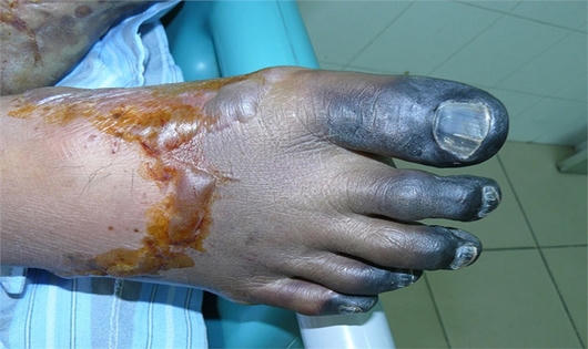 Hình ảnh hãi hùng vì ăn tiết canh khi mổ lợn đón Tết