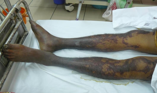 Hình ảnh hãi hùng vì ăn tiết canh khi mổ lợn đón Tết