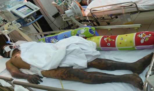 Hình ảnh hãi hùng vì ăn tiết canh khi mổ lợn đón Tết