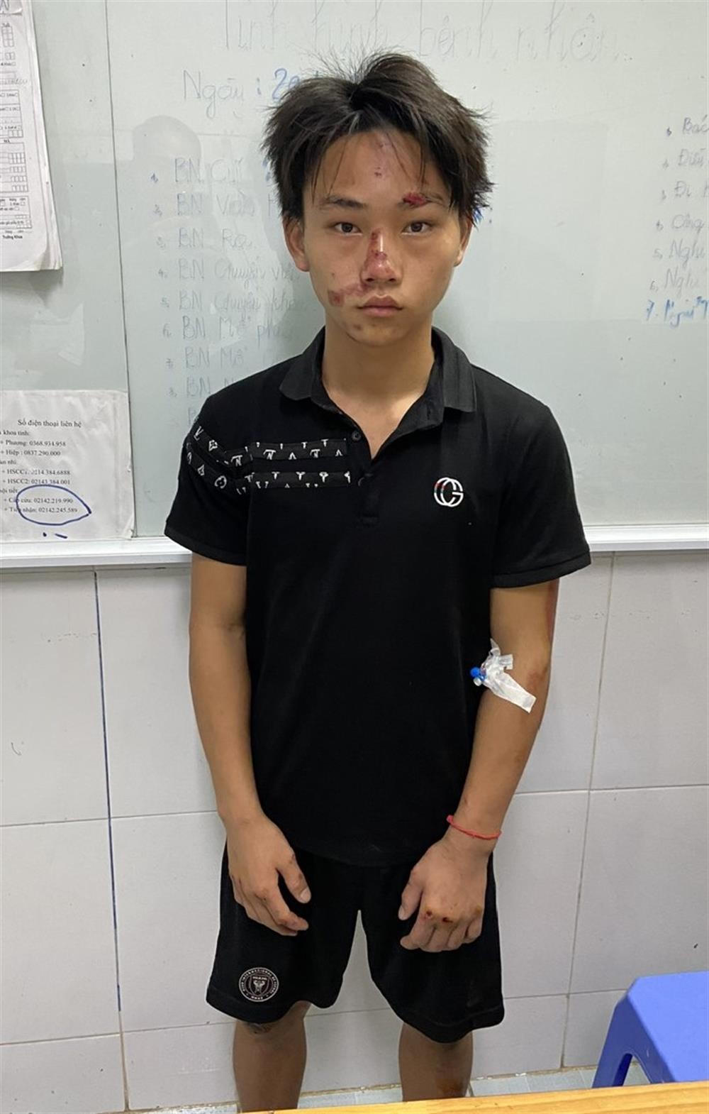 Tuần tra giao thông dịp nghỉ lễ 2/9, Thiếu tá công an bị đâm trọng thương