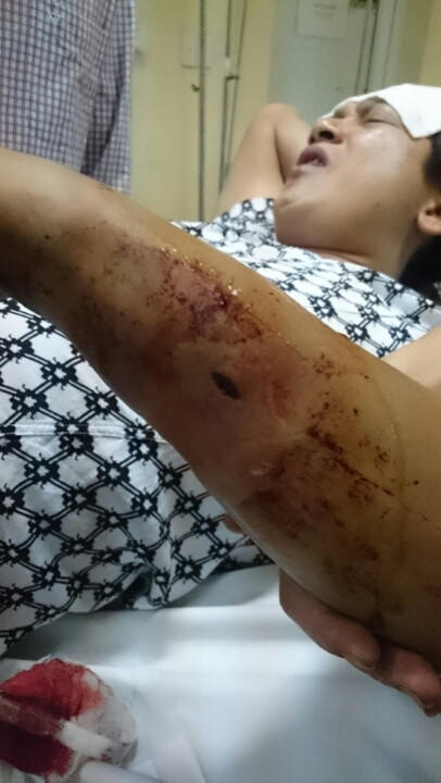 Bị đánh đập dã man, 3 công dân Quảng Ninh làm đơn kêu cứu