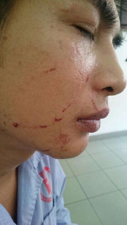 Ba công dân bị đánh đập dã man ở Quảng Ninh: Vì sao kẻ thủ ác vẫn nhởn nhơ ngoài vòng pháp luật? 