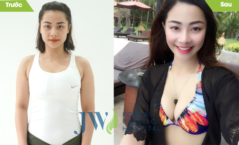 Bệnh viện thẩm mỹ JW Hàn quốc-Nơi khởi đầu cho nhan sắc mới