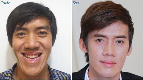 Bệnh viện thẩm mỹ JW Hàn quốc-Nơi khởi đầu cho nhan sắc mới