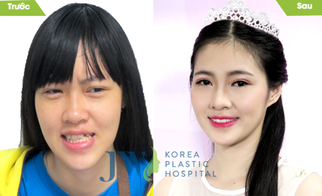 Bệnh viện thẩm mỹ JW Hàn quốc-Nơi khởi đầu cho nhan sắc mới