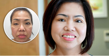 Bệnh viện thẩm mỹ JW Hàn quốc-Nơi khởi đầu cho nhan sắc mới