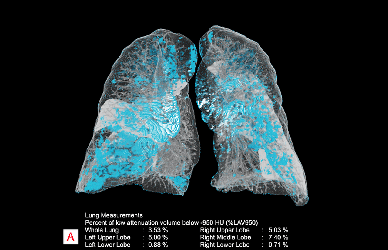 Trí tuệ nhân tạo: Chuyển đổi dữ liệu thành tri thức để chăm sóc sức khỏe người dân tốt hơn