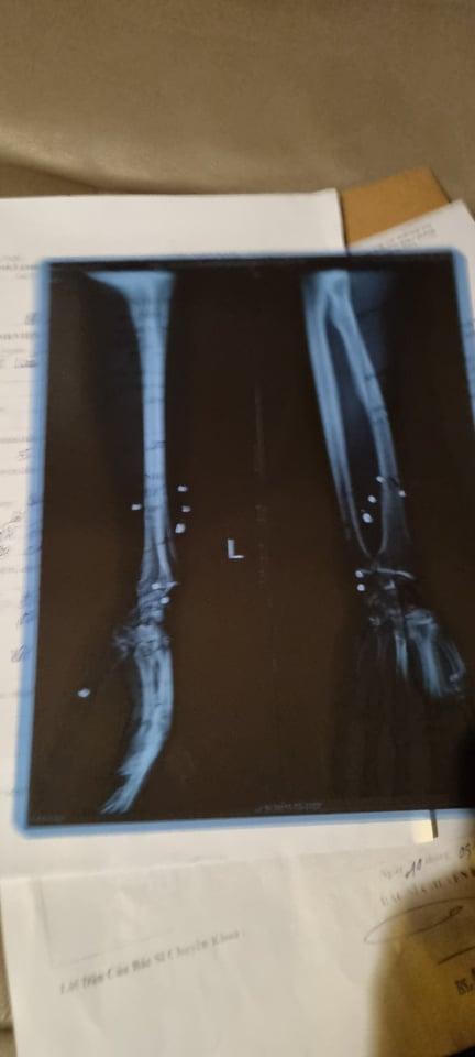 Vĩnh Phúc: Đang điều tra vụ “cát tặc” nổ súng khiến nhiều người bị thương