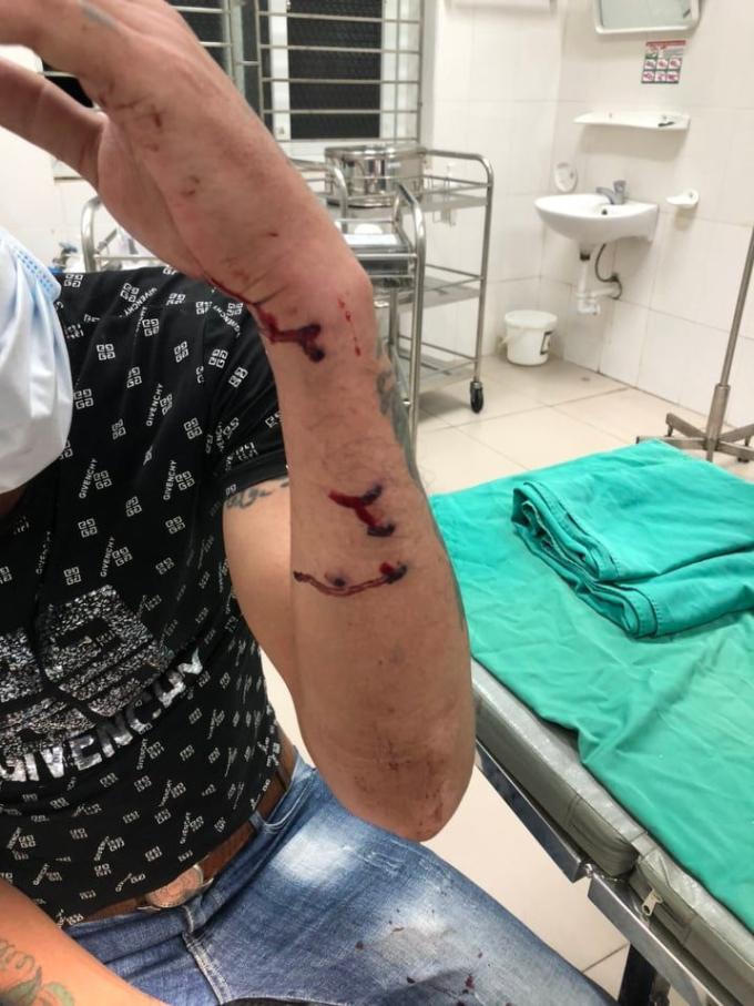 Vĩnh Phúc: Đang điều tra vụ “cát tặc” nổ súng khiến nhiều người bị thương