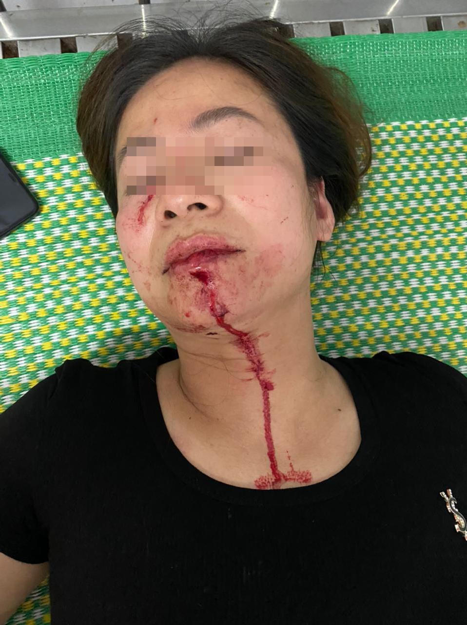 Thái Bình: Cần khởi tố, điều tra vụ người đàn ông đá giày vào mặt phụ nữ gây thương tích