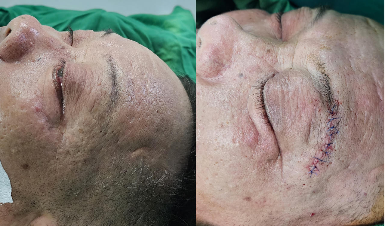 Căn bệnh khiến cụ ông không thể nhắm mắt