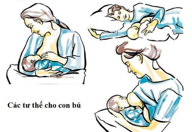 Trẻ sơ sinh tím tái sau vài phút bú sữa mẹ