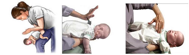 Trẻ sơ sinh tím tái sau vài phút bú sữa mẹ