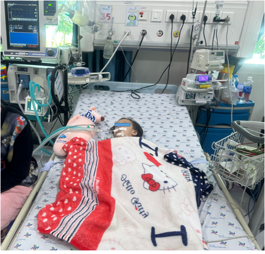 4 bệnh nhi bị tay chân miệng nặng, bác sĩ khuyến cáo biểu hiện cần đưa gấp trẻ tới viện