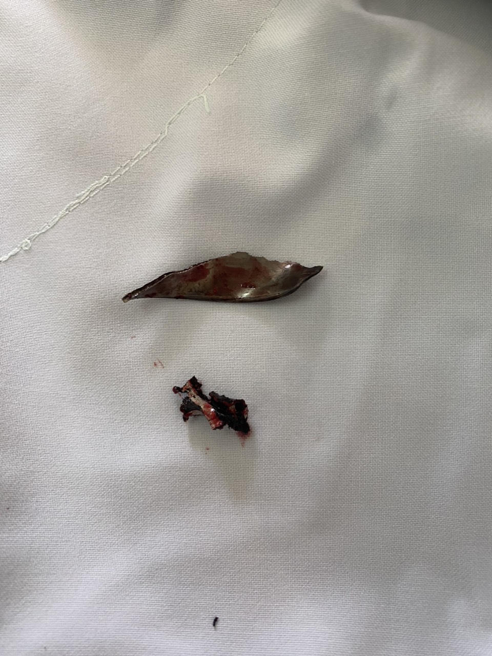 Lưỡi dao cắt cỏ cắm sâu vào ngực người đàn ông 