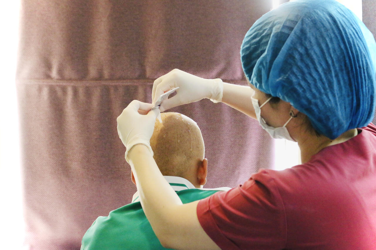 Rụng tóc nhiều, phải làm sao? 