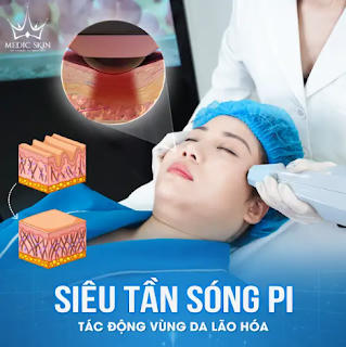 Công nghệ trẻ hoá, xoá nhăn Therart 6D tại Medic Skin - ‘Đánh thức’ làn da lão hoá