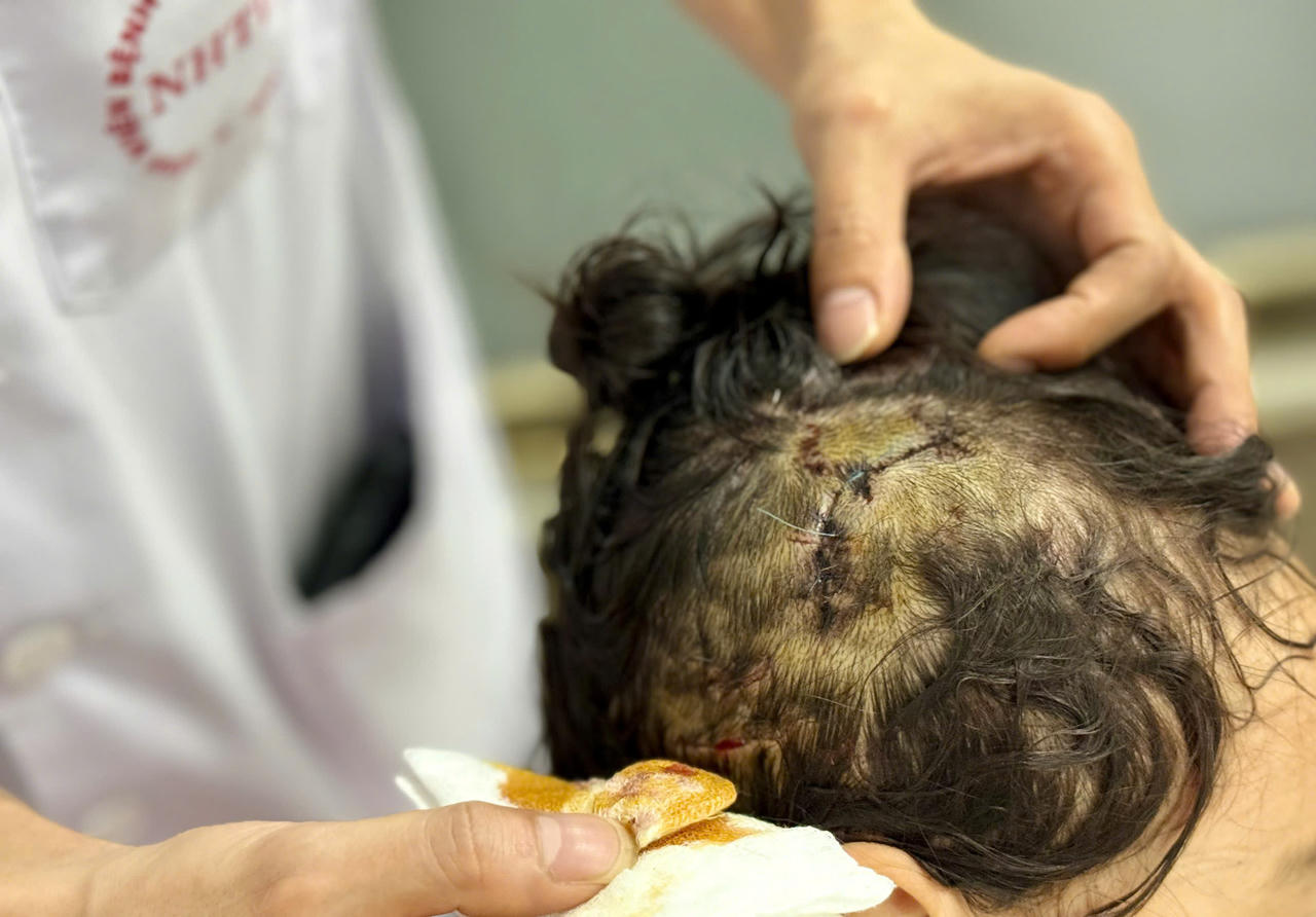 Nắng nóng, cảnh giác với chó nhà nuôi