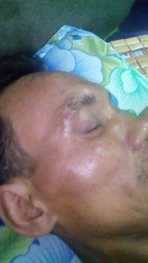 Đà Nẵng: Công an phường bị 'tố' đánh người tâm thần thương tích