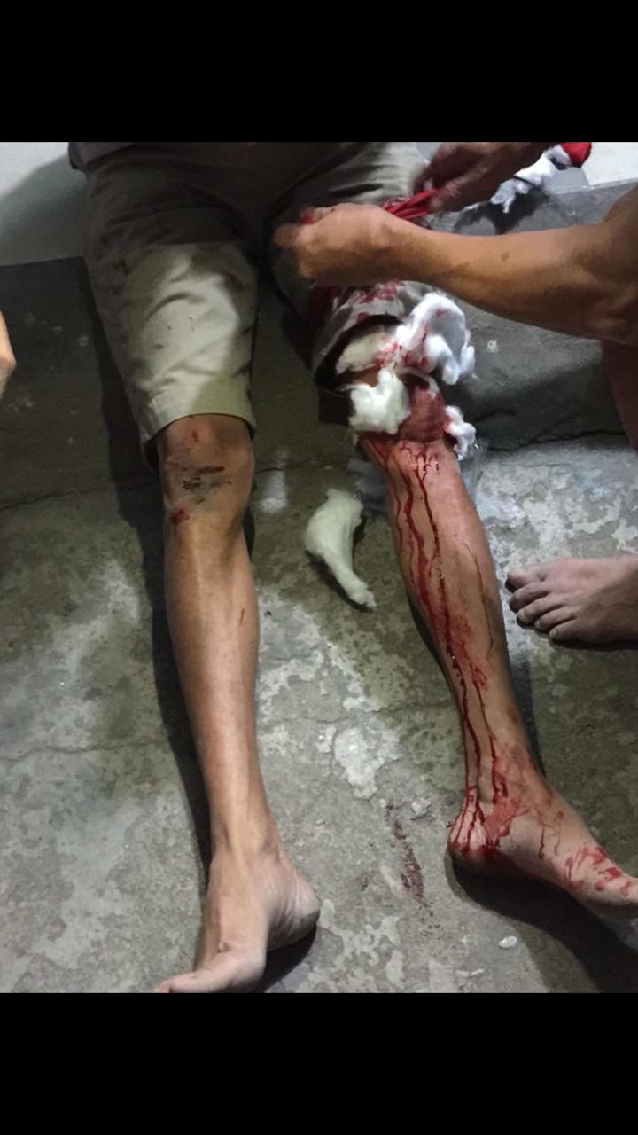 Kon Tum: Nguyên cán bộ Viện kiểm sát tỉnh bị “tố” dùng hung khí đâm người gây thương tích