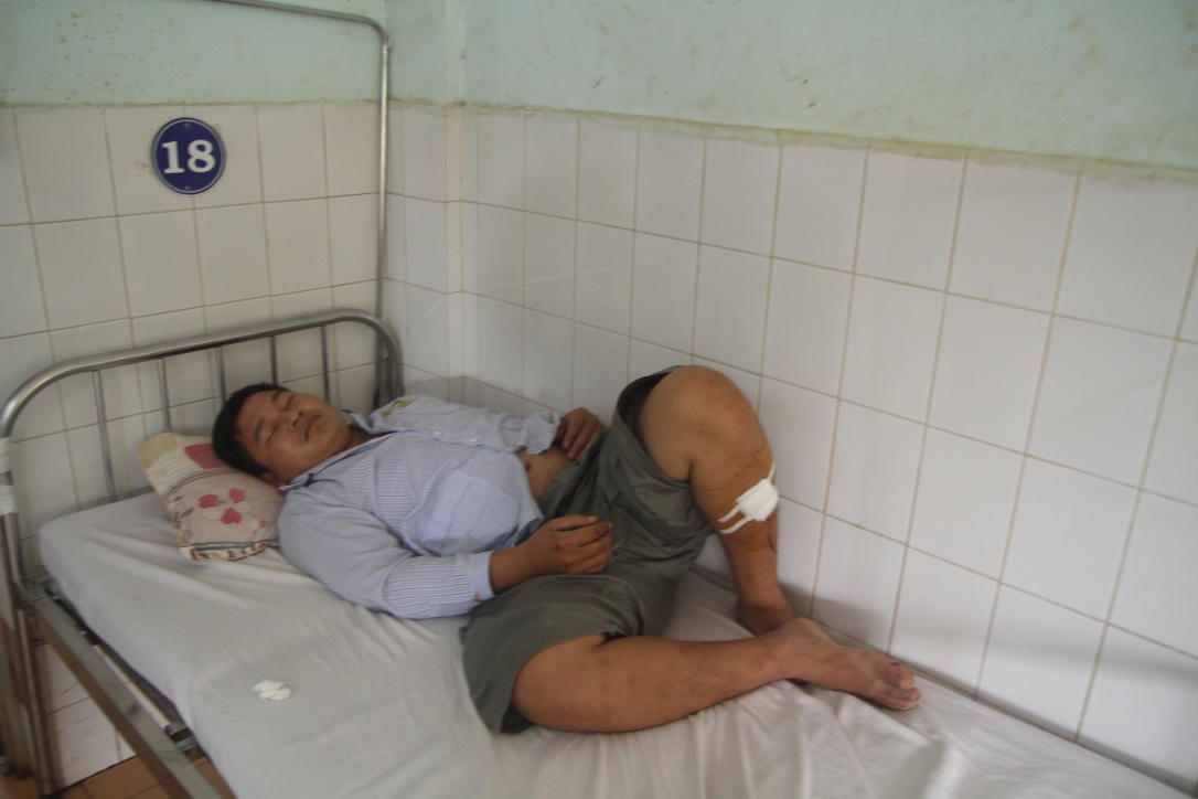 Bị chặn xe kiểm tra, đối tượng dùng dao chém 4 chiến sĩ Công an bị thương