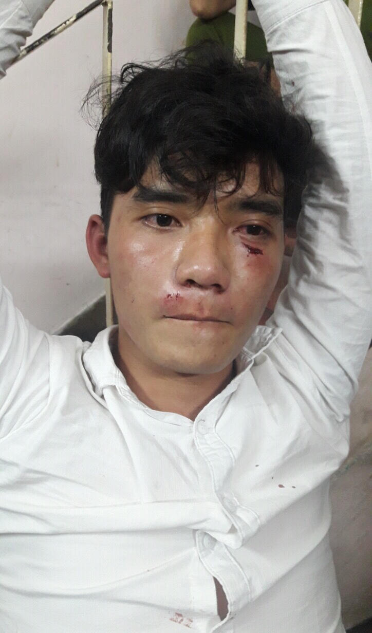 Hai nam thanh niên dùng gạch tấn công công an