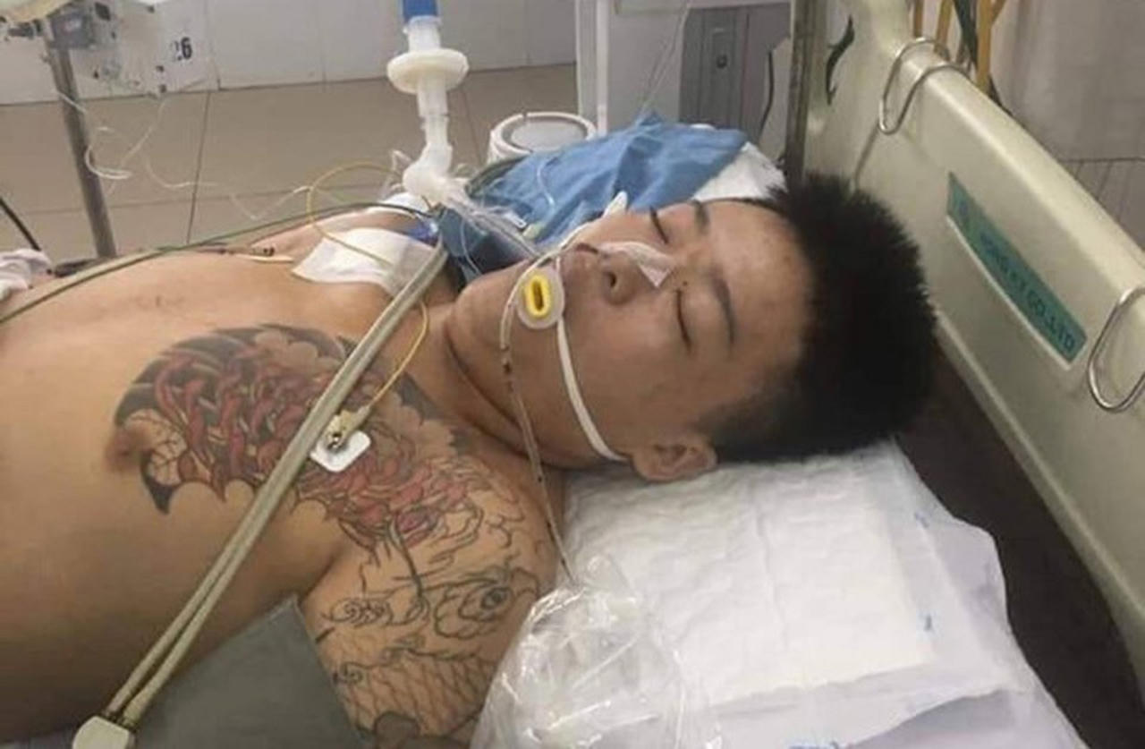 Vụ bị can cấp cứu tại Đà Nẵng: Mắc hội chứng toan aceton, không có tổn thương do sang chấn, 