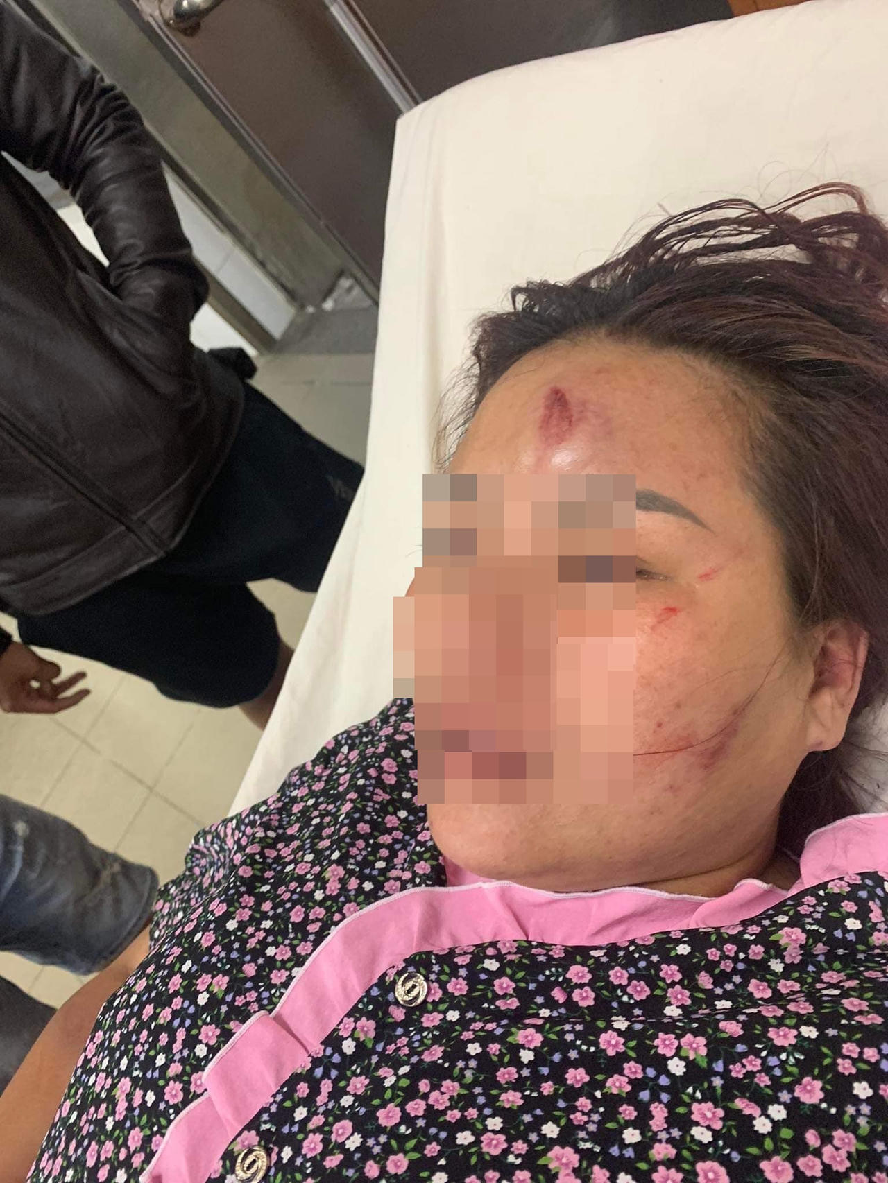 Điều tra vụ chồng đánh vợ dã man tại Đà Nẵng