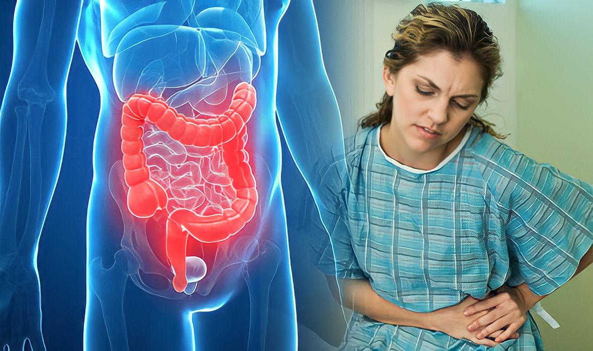 Cách cải thiện đại tràng tại nhà cực đơn giản và hiệu quả